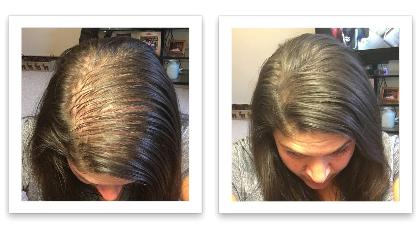 Demonstration of patting the dark brown hair fibers onto a widening hair part line