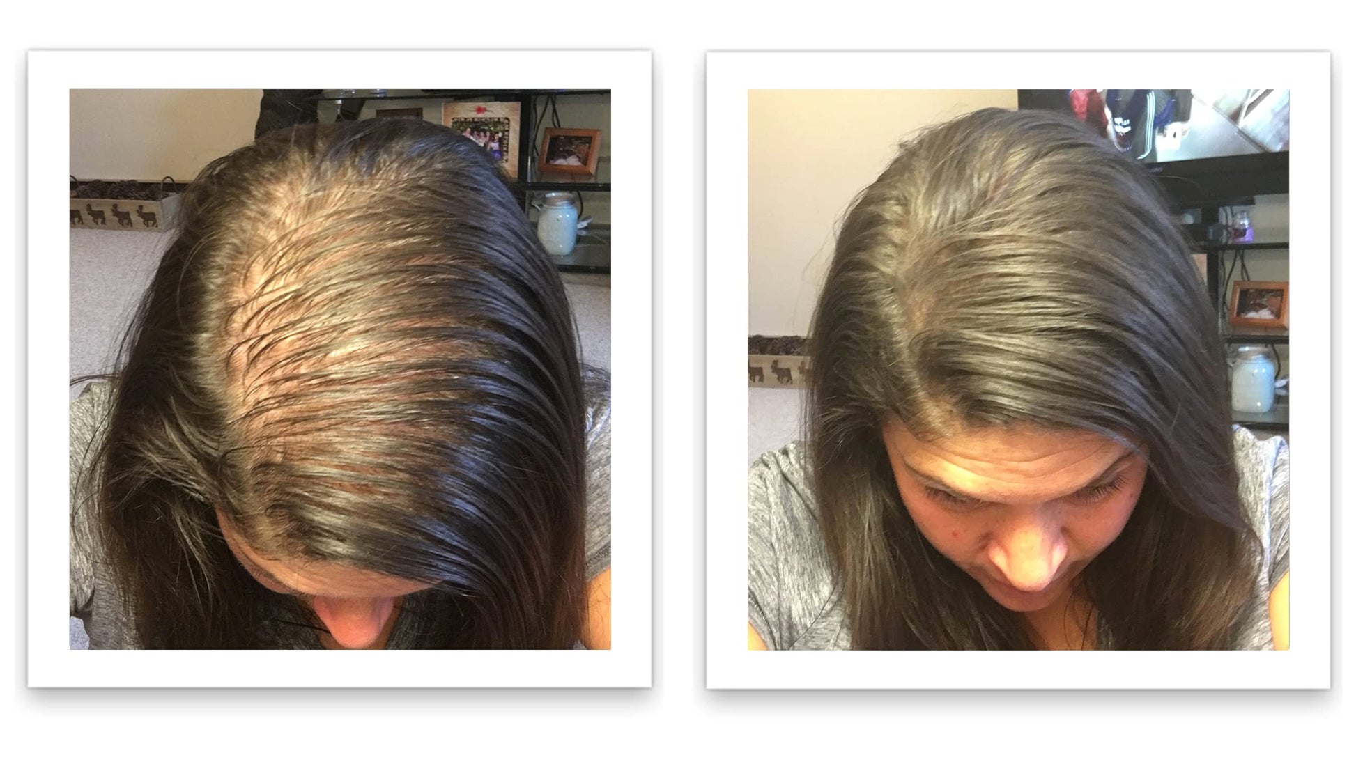 Demonstration of patting the dark brown hair fibers onto a widening hair part line