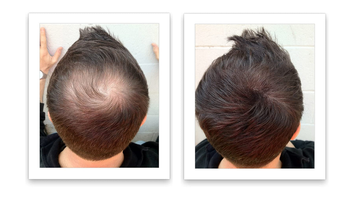 Caboki natural plant-based hair fiber container resting on clean surface