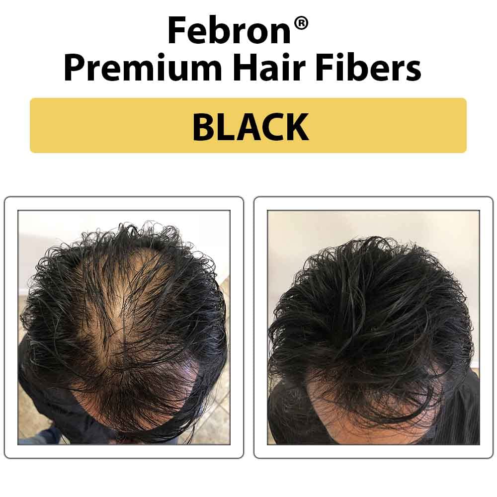 Febron Hair Building Fibers Black 30 Grams dispensing sifter cap close up