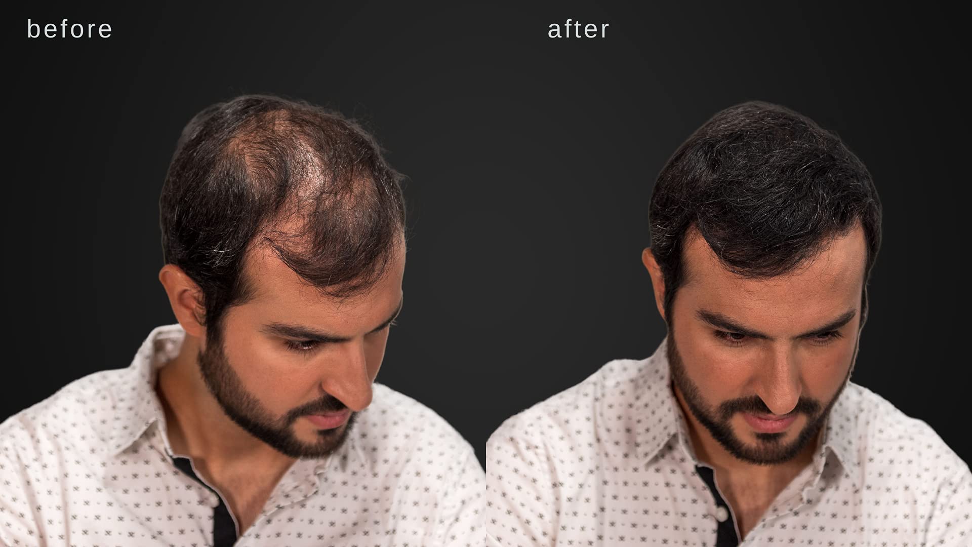 LUXE Professional hair thickening powder package displaying the two month supply guarantee