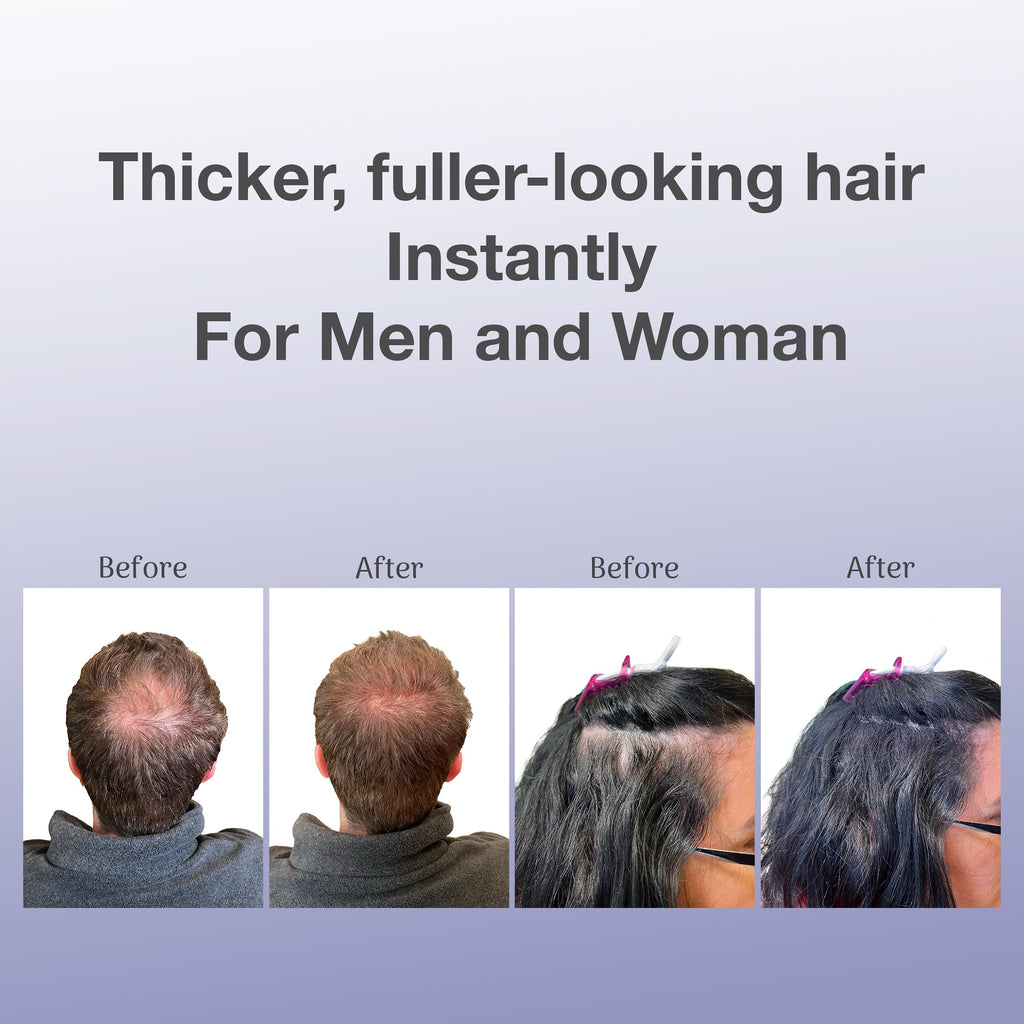 BosleyMD hair thickening fibers box packaging exterior