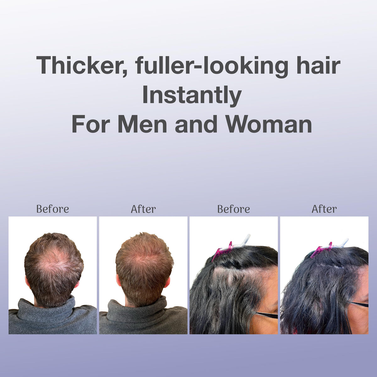 BosleyMD hair thickening fibers box packaging exterior