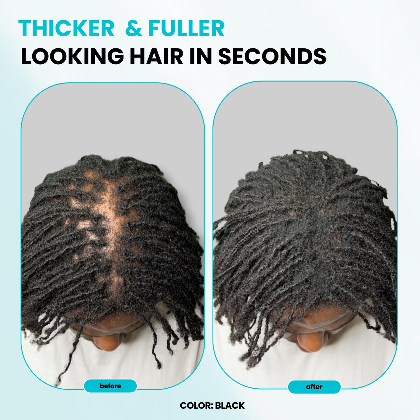 SureThik premium scalp concealment hair fibers package displaying brand logo