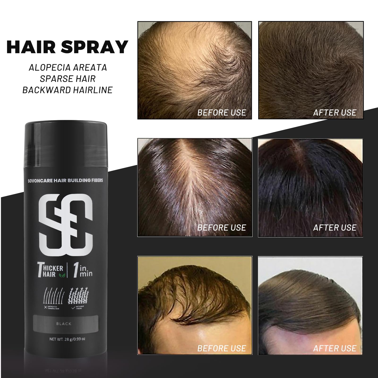 SOVONCARE black keratin powder container showcasing premium imported packaging for bald spot coverage