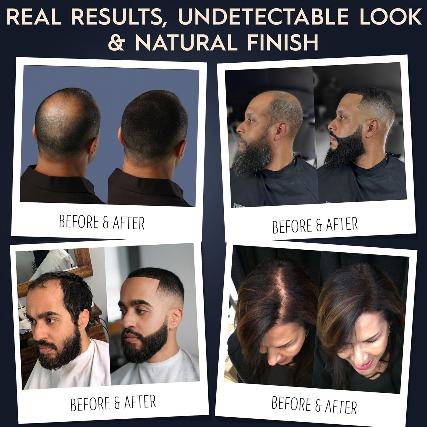 Before and after demonstration of real hair fibers covering thinning crown areas.