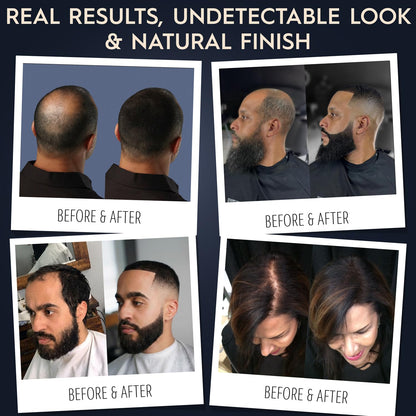 Before and after demonstration of real hair fibers covering thinning crown areas.