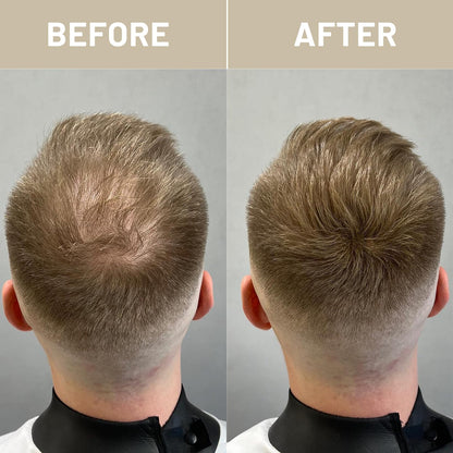 Before and after application demonstration of Volluck hair volumizing fiber powder on a thinning crown