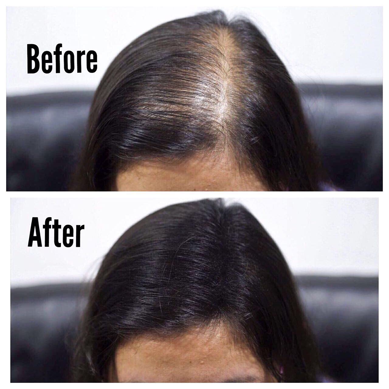 Thick Fiber hair loss concealer bottle displaying premium natural keratin ingredients