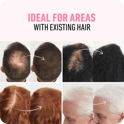Side by side visual comparison of thinning hair before and after using Boldify powder.