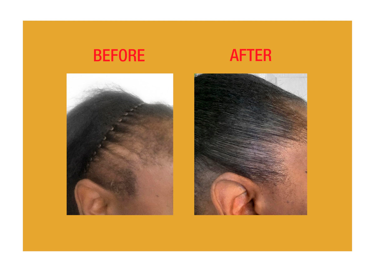 Gold Banner Beauty Good2Gro Biotin Leave-In Conditioner lifestyle image with healthy hair