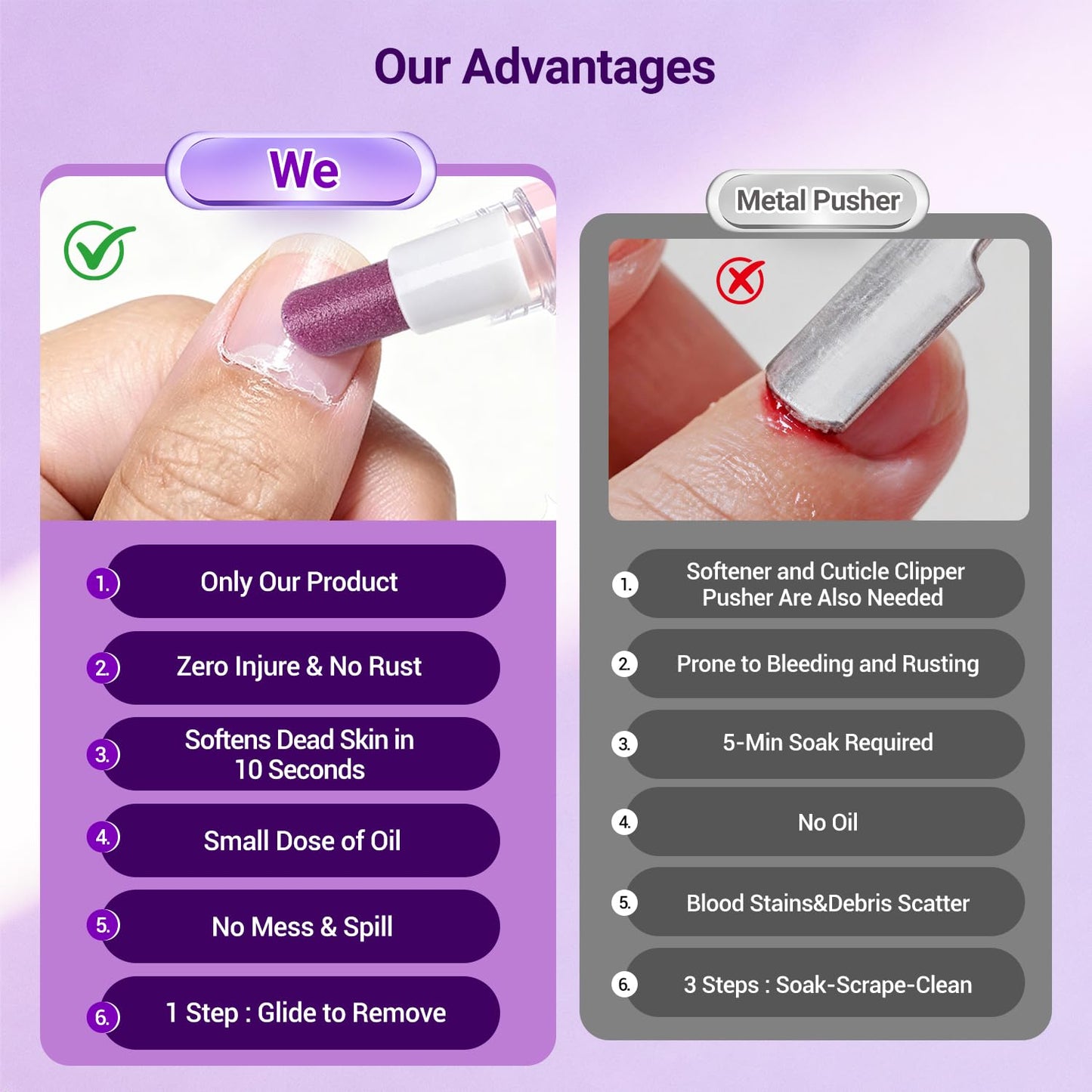 Before and after results using the JODSONE hangnail prevention treatment.