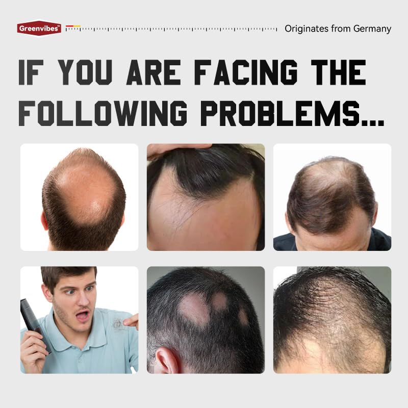 Application of anti-thinning hair spray on scalp
