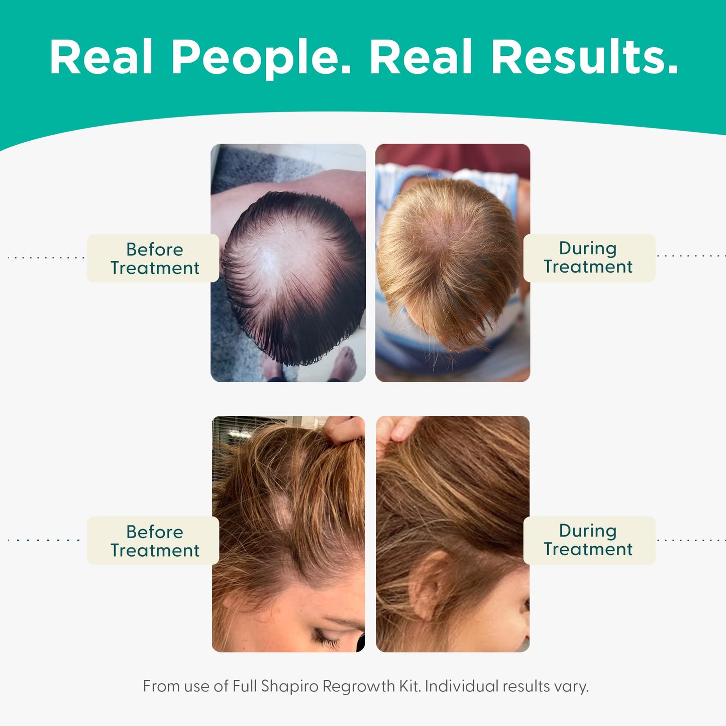 Shapiro MD hair growth leave-in conditioner packaging