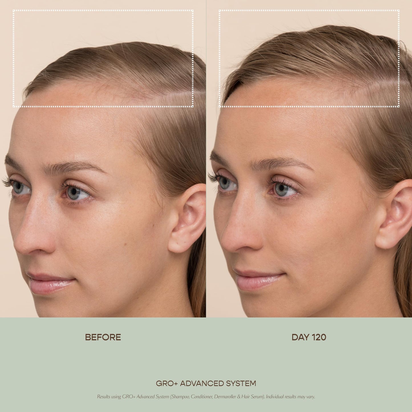 Vegamour Gro Plus Advanced Balancing Conditioner for thinning hair