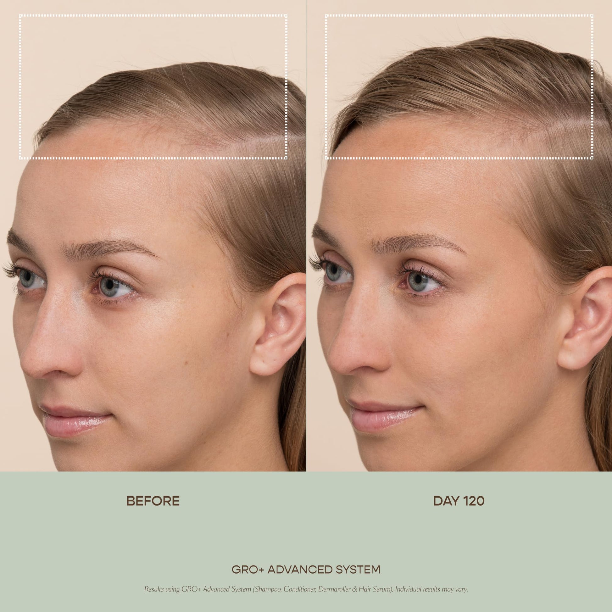 Vegamour Gro Plus Advanced Balancing Conditioner for thinning hair
