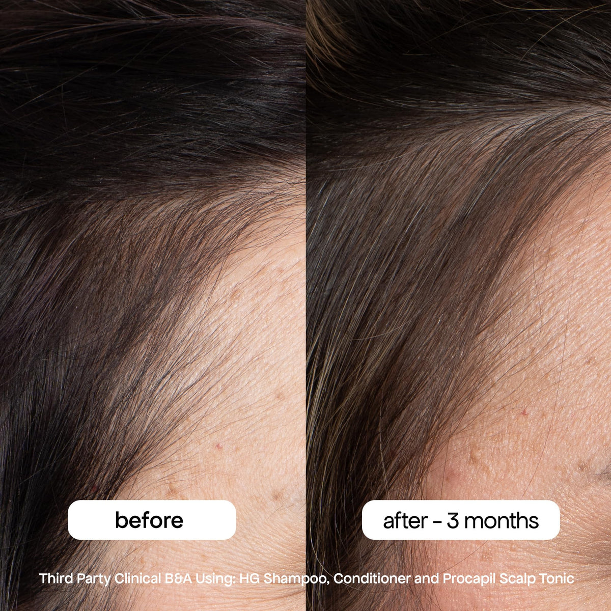 BondiBoost shampoo and conditioner set back view with ingredients