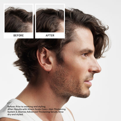 Nioxin System 2 professional thinning hair conditioner bottle showing ingredients