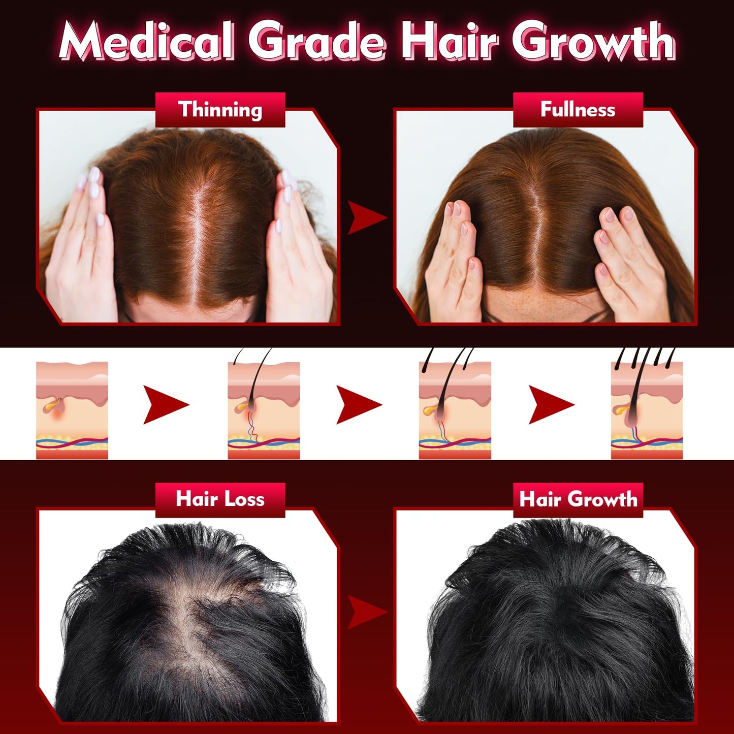 Gwode laser hair cap with power controller