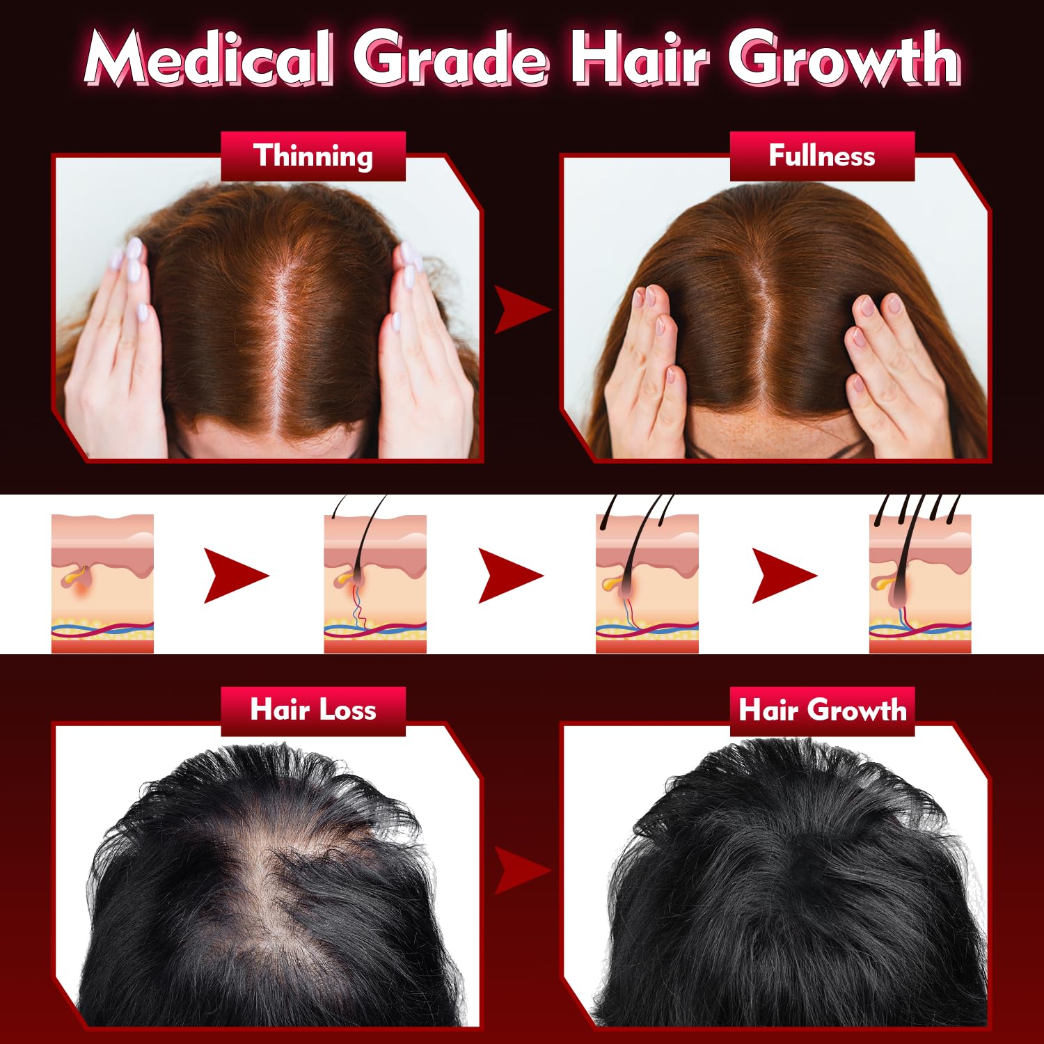 Gwode laser hair cap with power controller