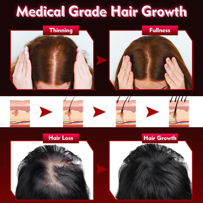 Gwode laser hair cap with power controller
