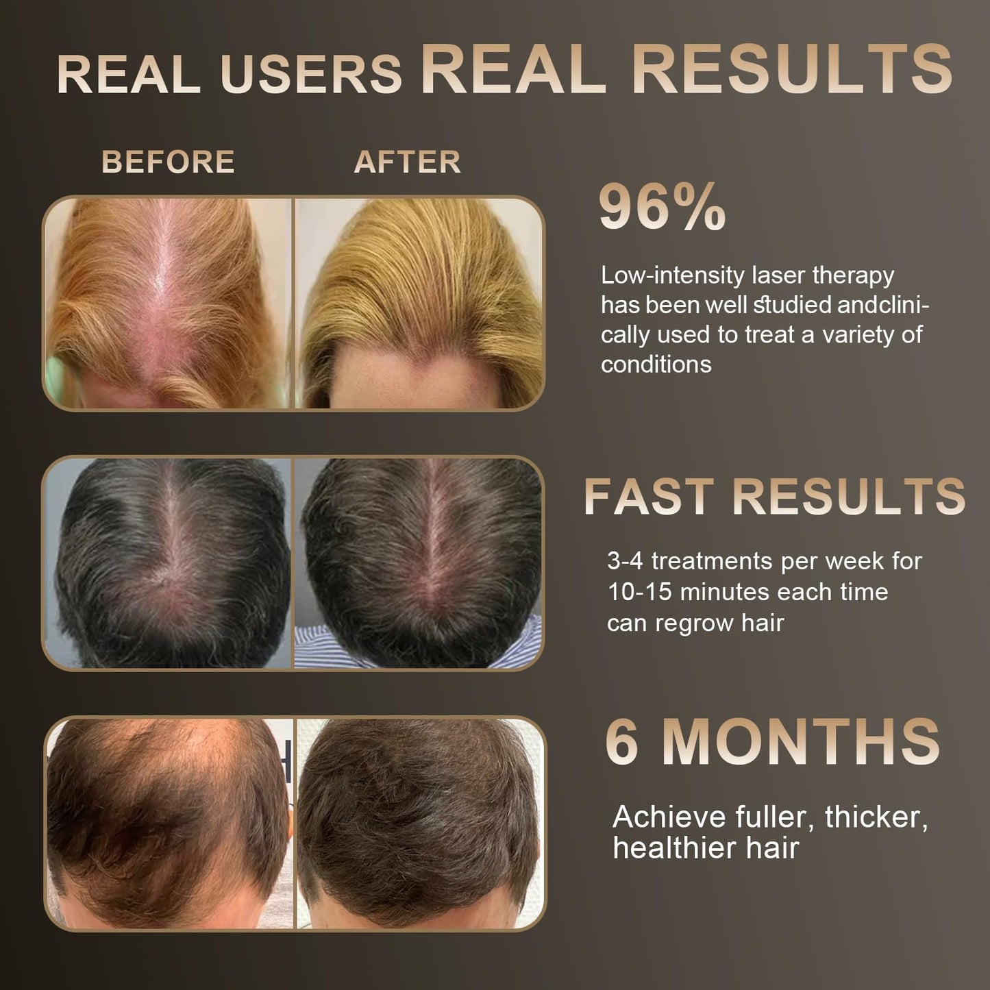 Close up of laser therapy bristles on hair growth device