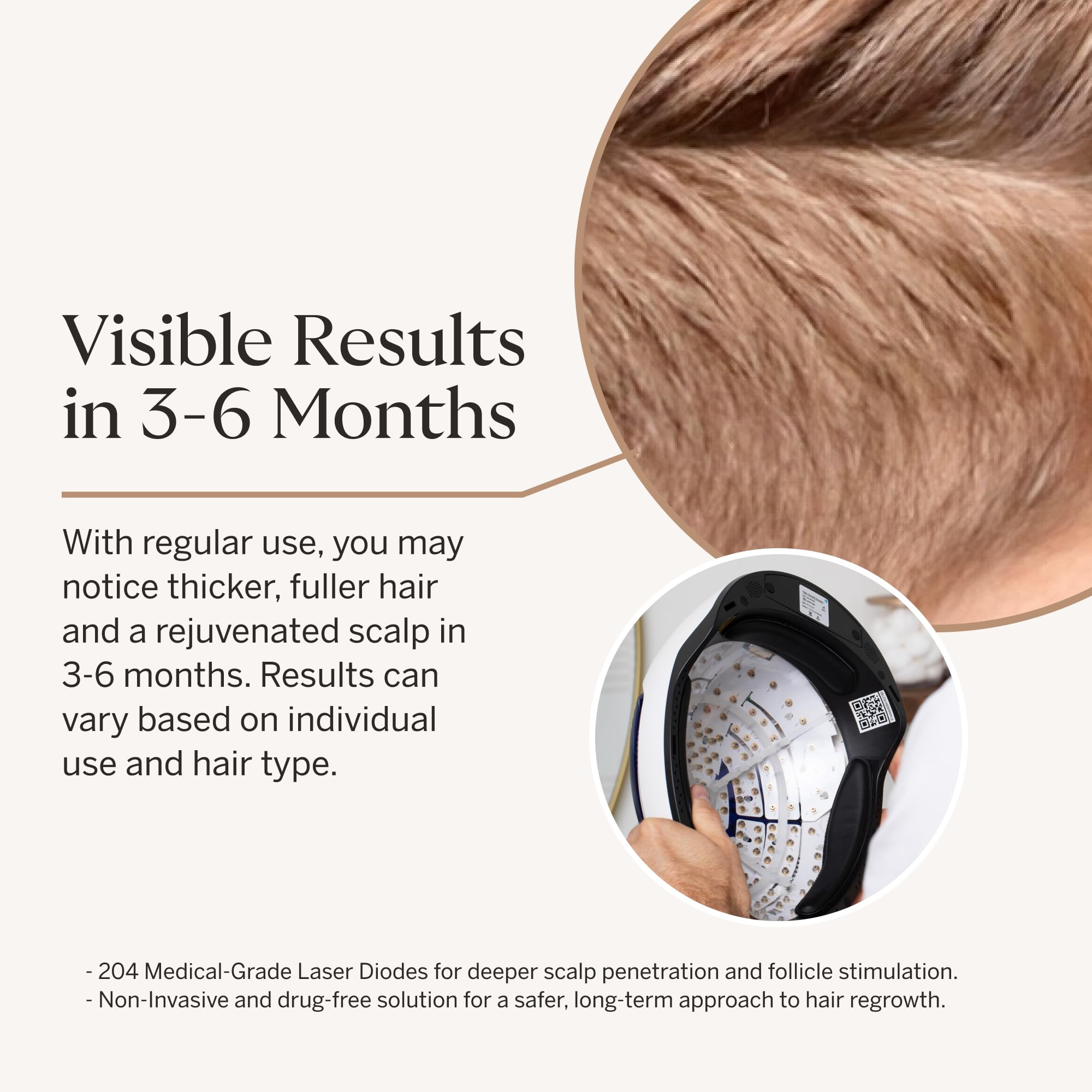 Happy Head laser hair growth helmet side profile
