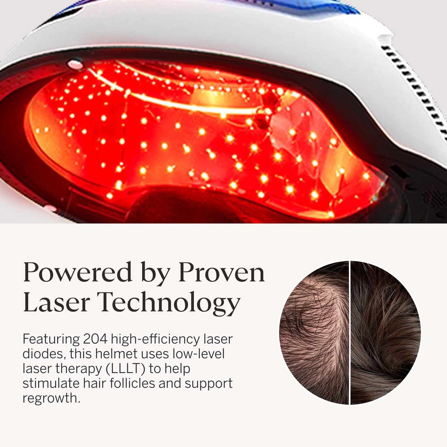 Person using Happy Head hair growth helmet at home