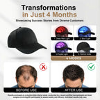 Whixant portable scalp therapy cap side profile