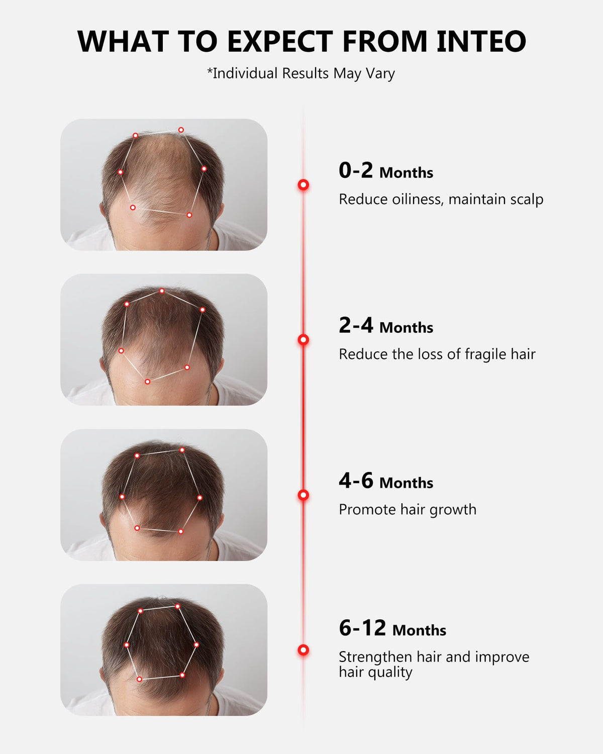 Inteo wireless hair loss treatment cap side profile