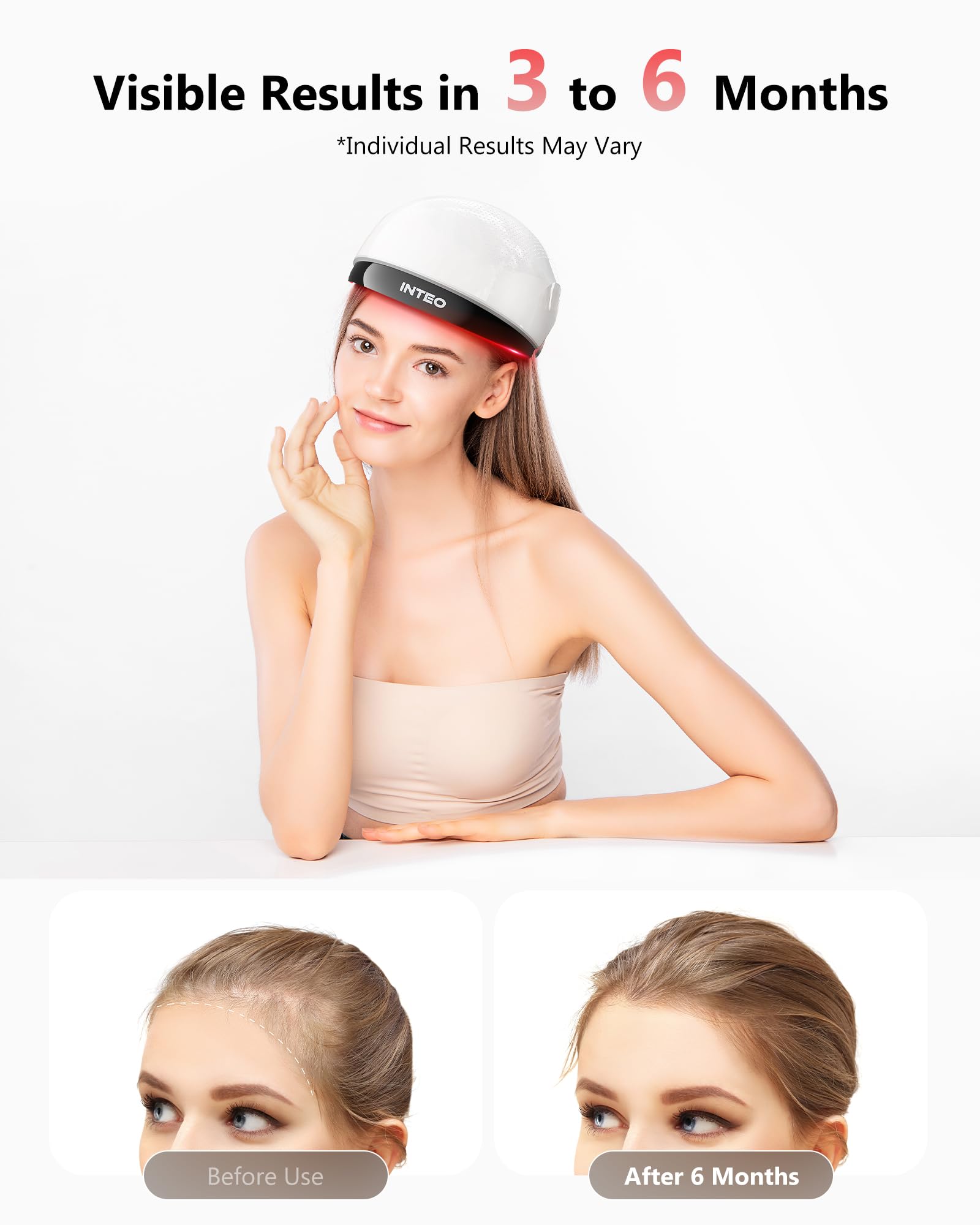 Inteo FDA cleared laser hair growth helmet packaging