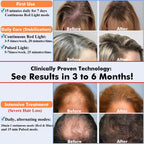 GWODE hair regrowth device worn on head for home use treatment.