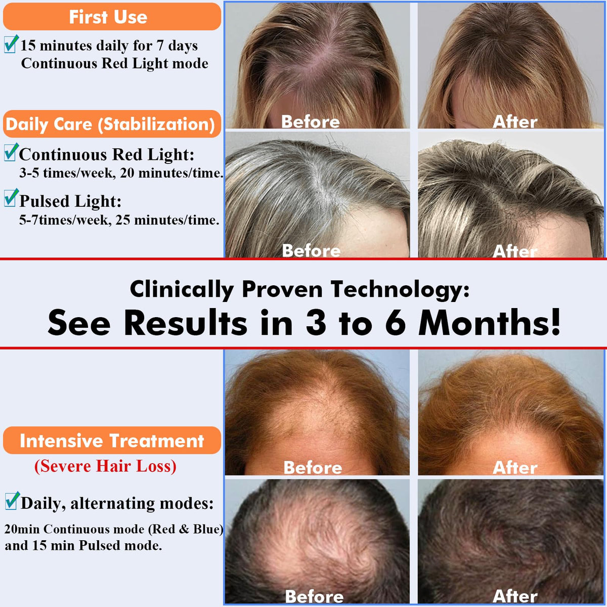 GWODE hair regrowth device worn on head for home use treatment.