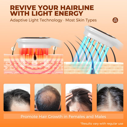 Protouch hair growth comb showcasing the electric scalp massager points