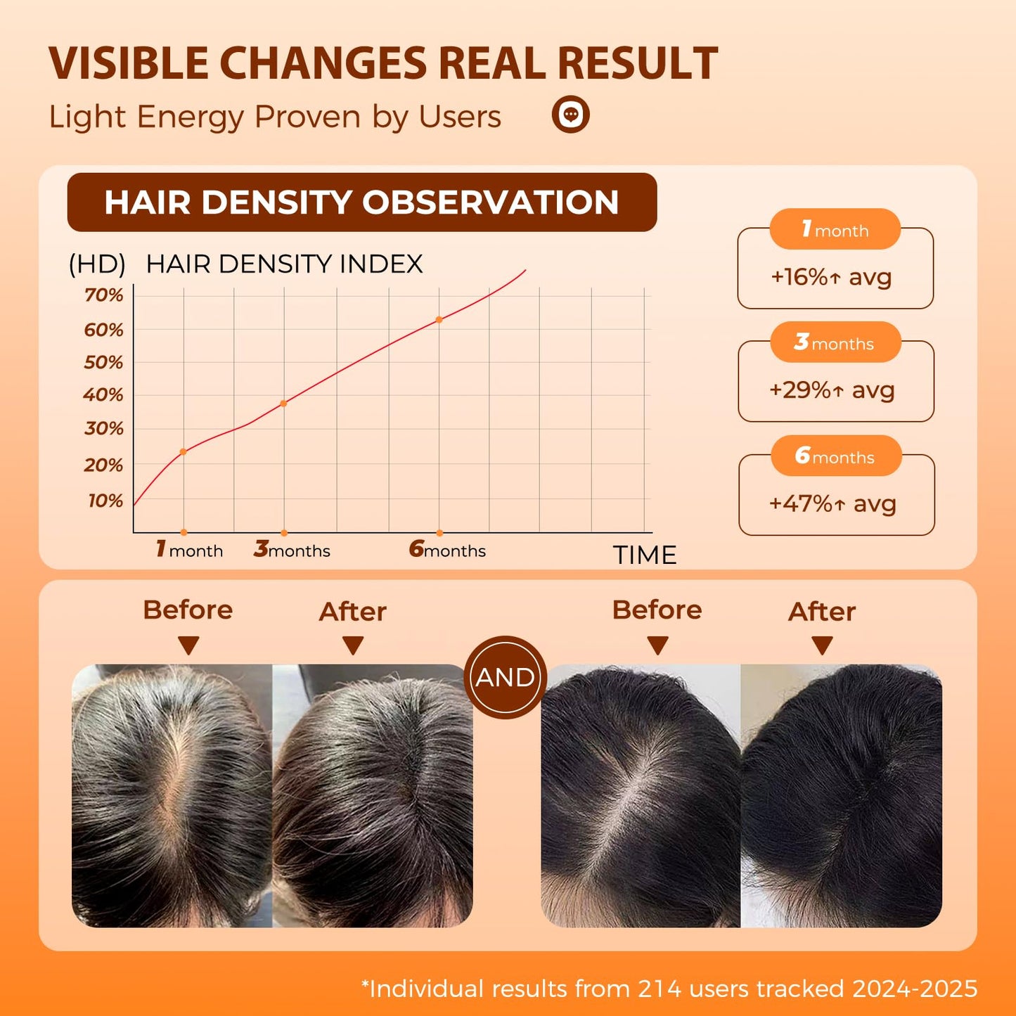 Side profile of Protouch laser therapy device for hair loss