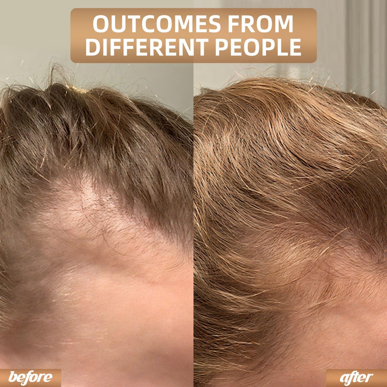 Carviki hair growth cap quick release panel detail
