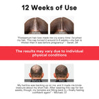Skillyes red light therapy hair growth cap interior LED panel