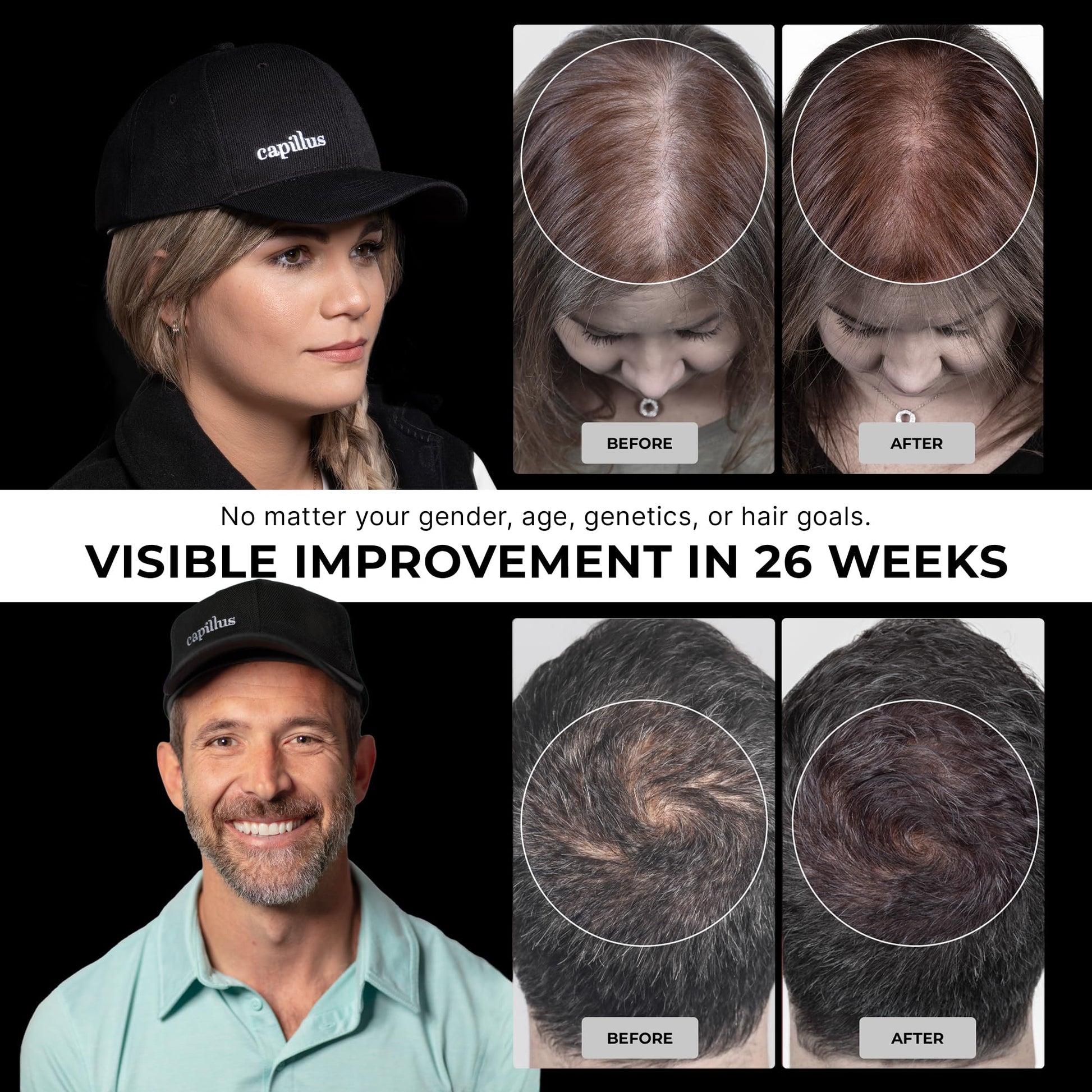 Capillus Pro S2 red light therapy hat internal diode view