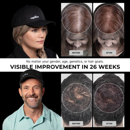 Capillus Pro S2 red light therapy hat internal diode view