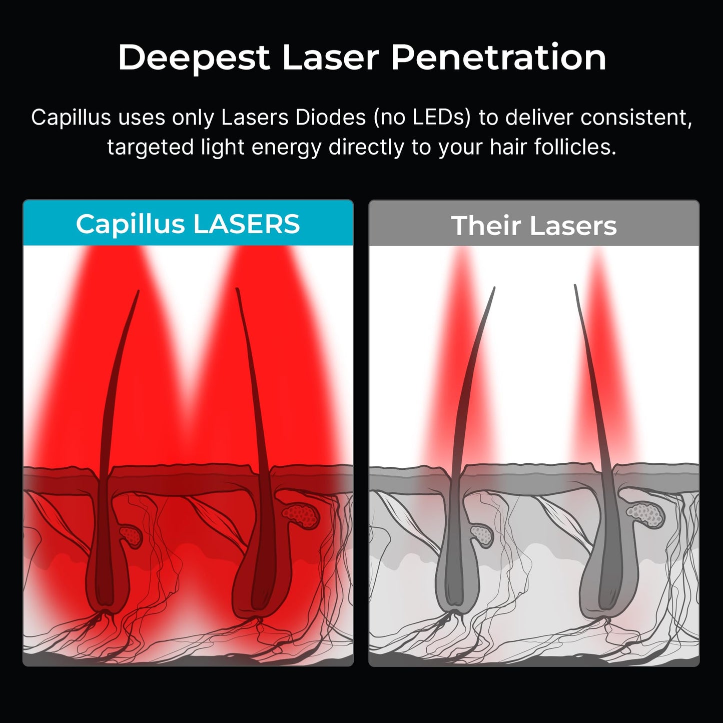 User wearing Capillus Pro S2 laser cap for hair regrowth