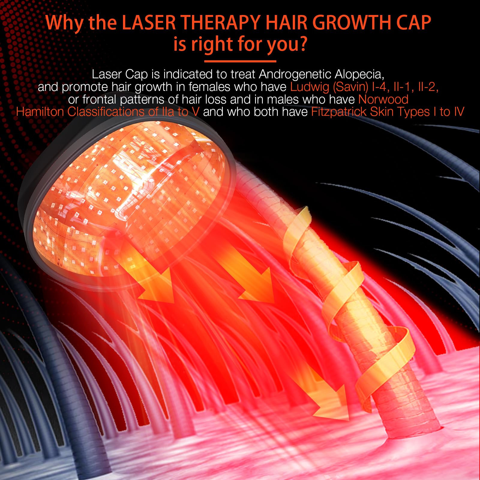 Interior view showing laser placement in Pupca cap