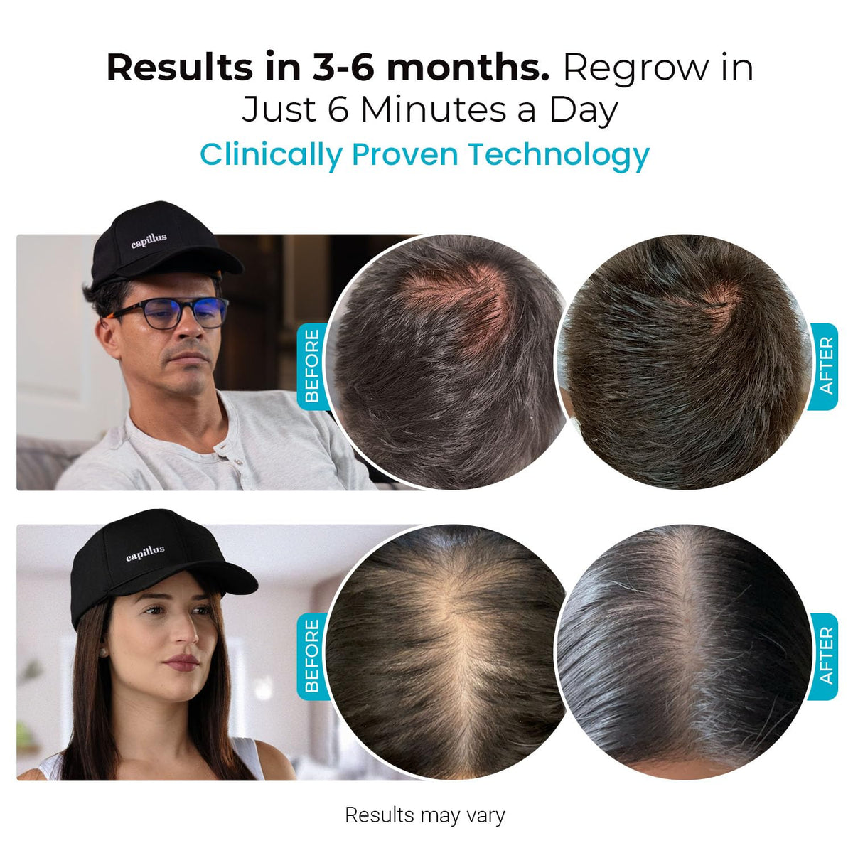 Smart Cap Capillus Spectrum laser therapy cap side profile