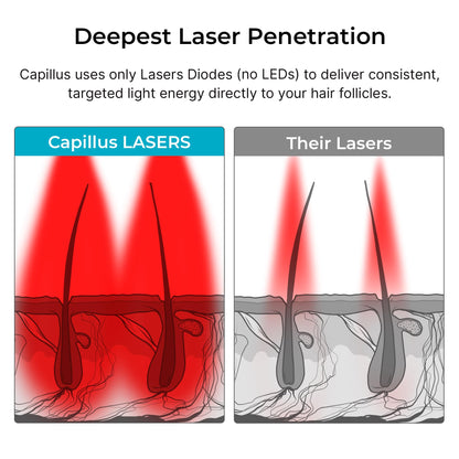 Man using Capillus Pro laser hair loss treatment cap
