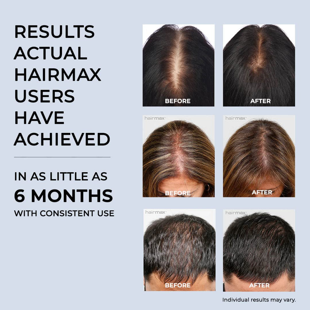 HairMax LaserBand 41 instruction manual and warranty details