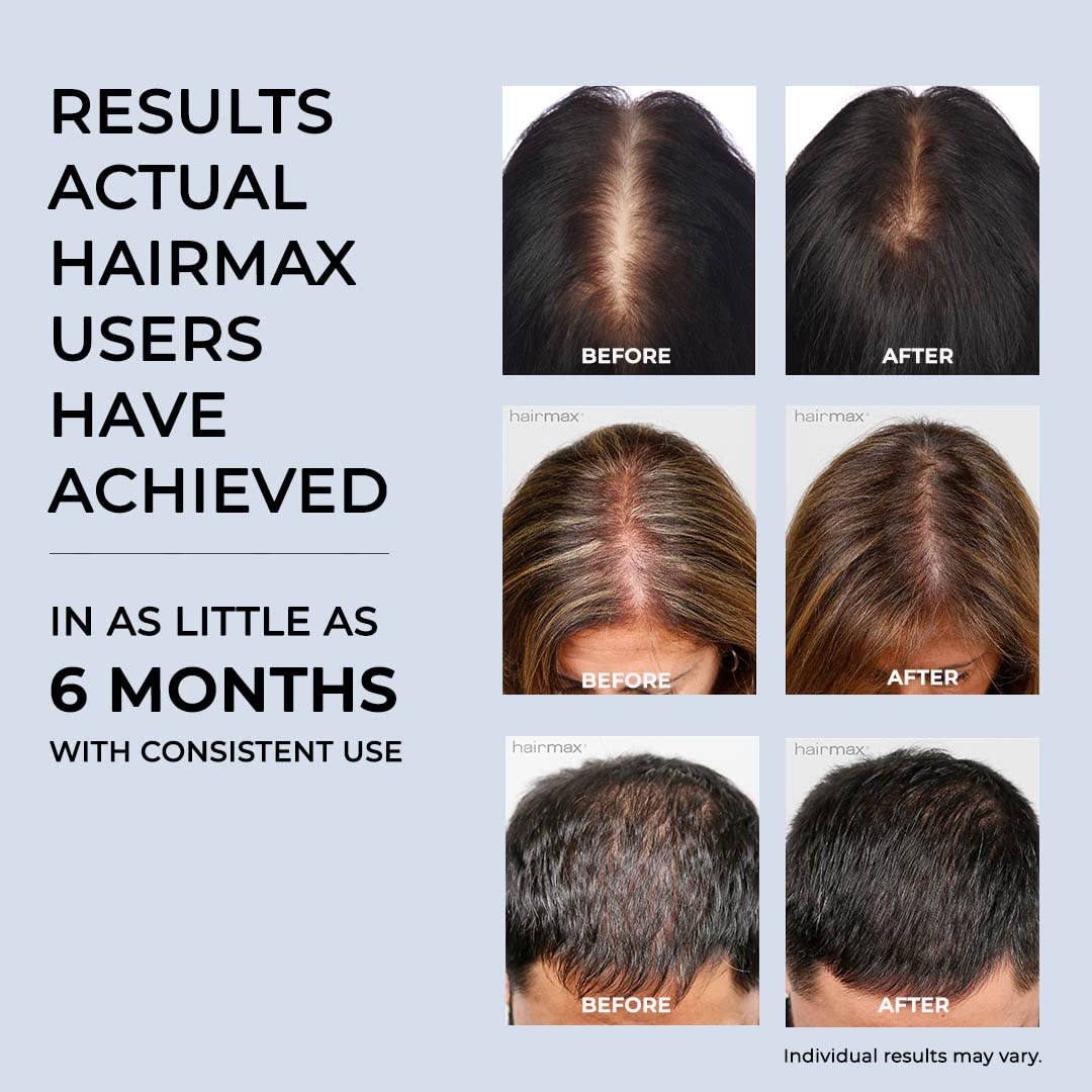 HairMax LaserBand 41 instruction manual and warranty details