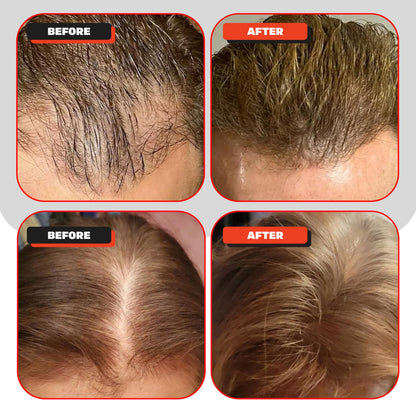 Kiierr 272 Premier packaging and included hair care components