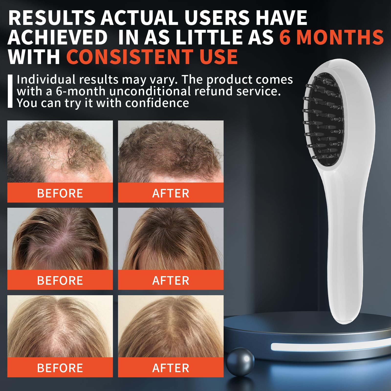 Close up of laser comb teeth for effective scalp penetration