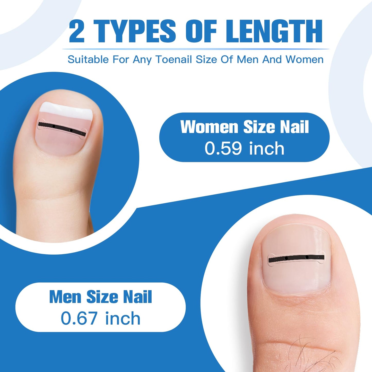 Close up of titanium alloy nail correction patch on toe