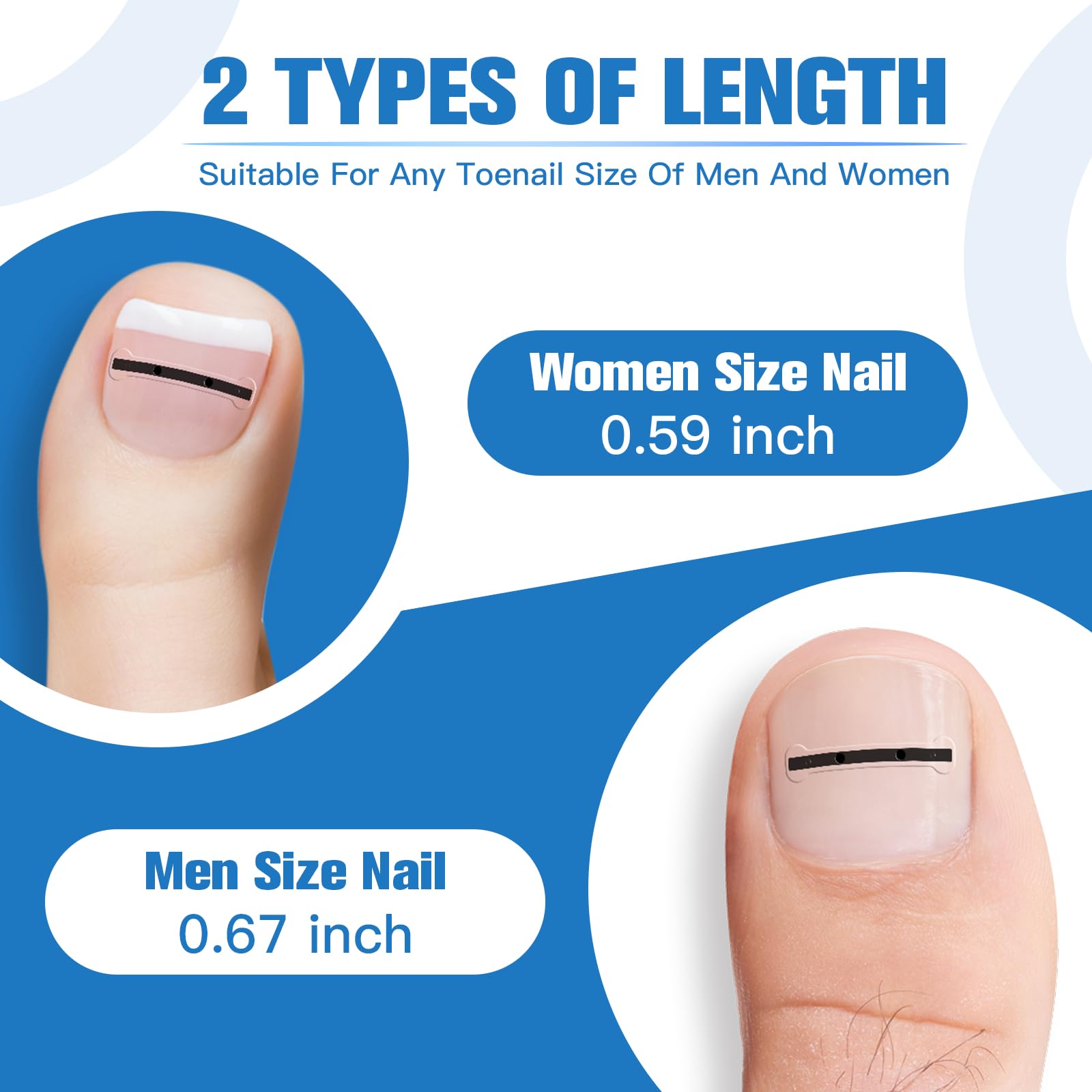 Close up of titanium alloy nail correction patch on toe