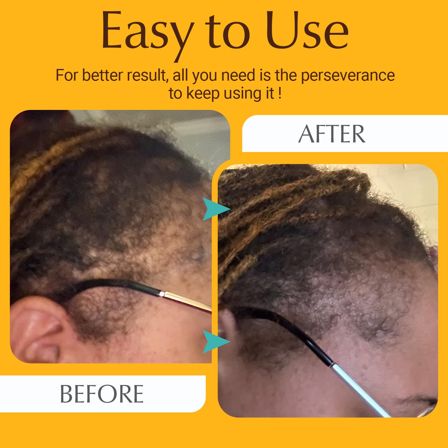 Protouch electric hair growth comb showing light therapy mode